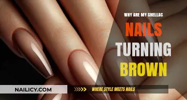 Why Shellac Nails Turn Brown: Causes and Prevention Tips