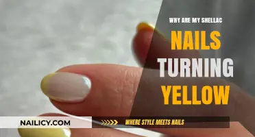 Why Shellac Nails Turn Yellow: Causes And Prevention Tips | Nailicy