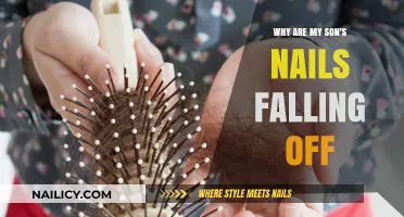 Understanding Why Your Son's Nails Are Falling Off: Causes and Solutions