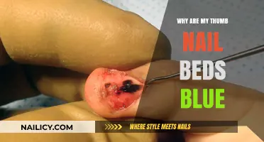 Blue Thumb Nail Beds: Causes, Concerns, and When to Seek Help