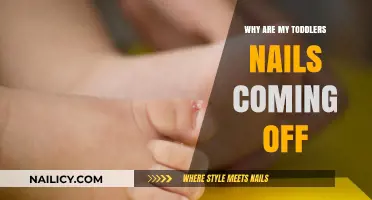 Toddler Nail Loss: Causes, Concerns, and When to Seek Help