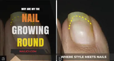 Toe Nails: Why Do They Curve?