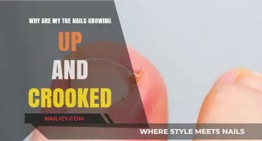 Toe Nails: Why Do They Grow Crooked?