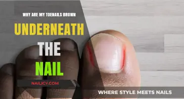 Brown Toenails: Causes and Concerns Underneath the Nail