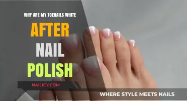White Toenails After Polish: Causes and Solutions Explained