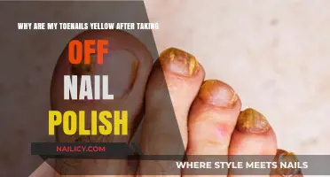 Yellow Toenails After Nail Polish: Causes and Solutions Explained