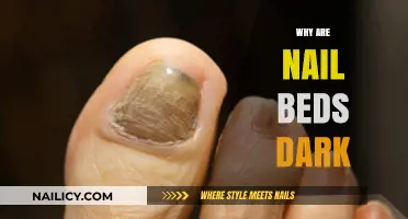 Why Do Nail Beds Turn Dark? Causes and Concerns Explained