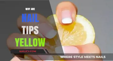 Why Are My Nail Tips Yellow? Causes and Solutions Explained