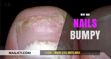 Why Are Nails Bumpy? Causes and Solutions for Uneven Nail Texture