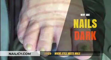 Understanding Dark Nails: Causes, Concerns, and When to Seek Help