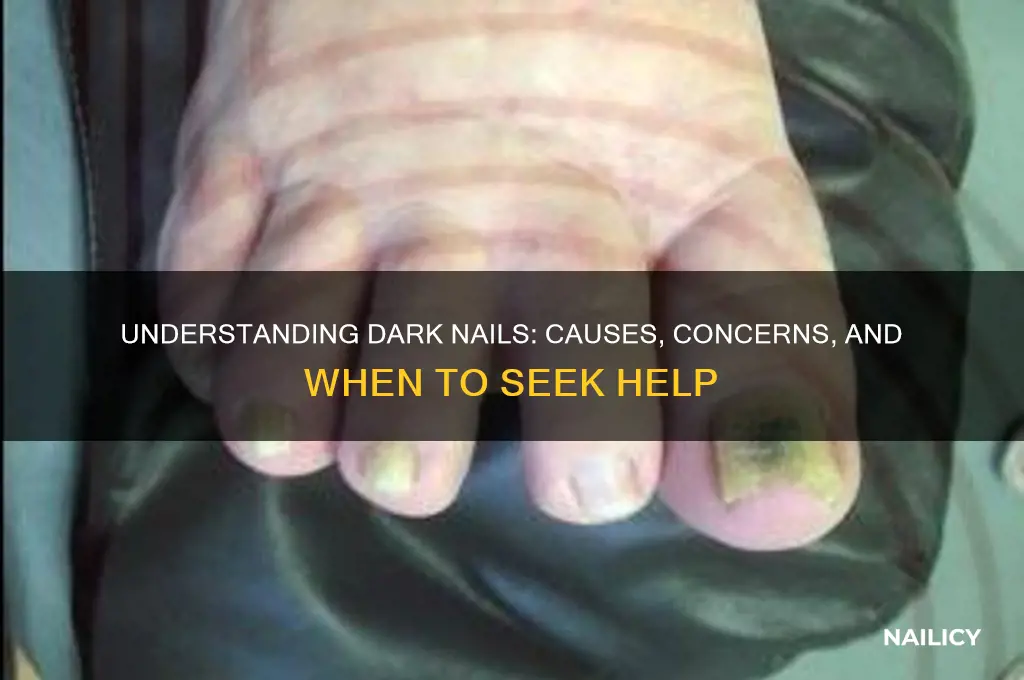 why are nails dark