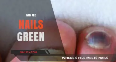 Why Are Nails Green? Causes, Concerns, and Solutions Explained