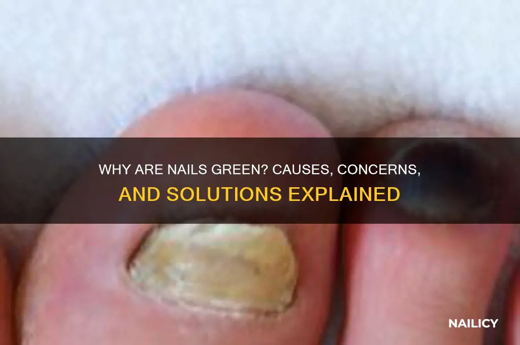 why are nails green
