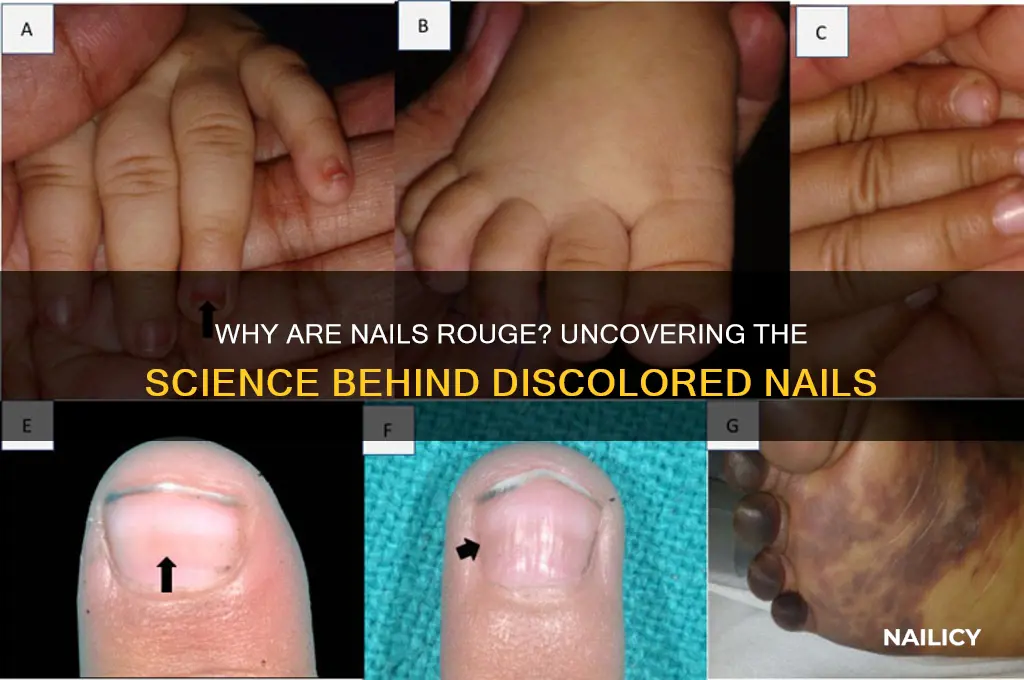 why are nails roges