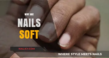 Why Are Nails Soft? Causes, Prevention, and Effective Solutions