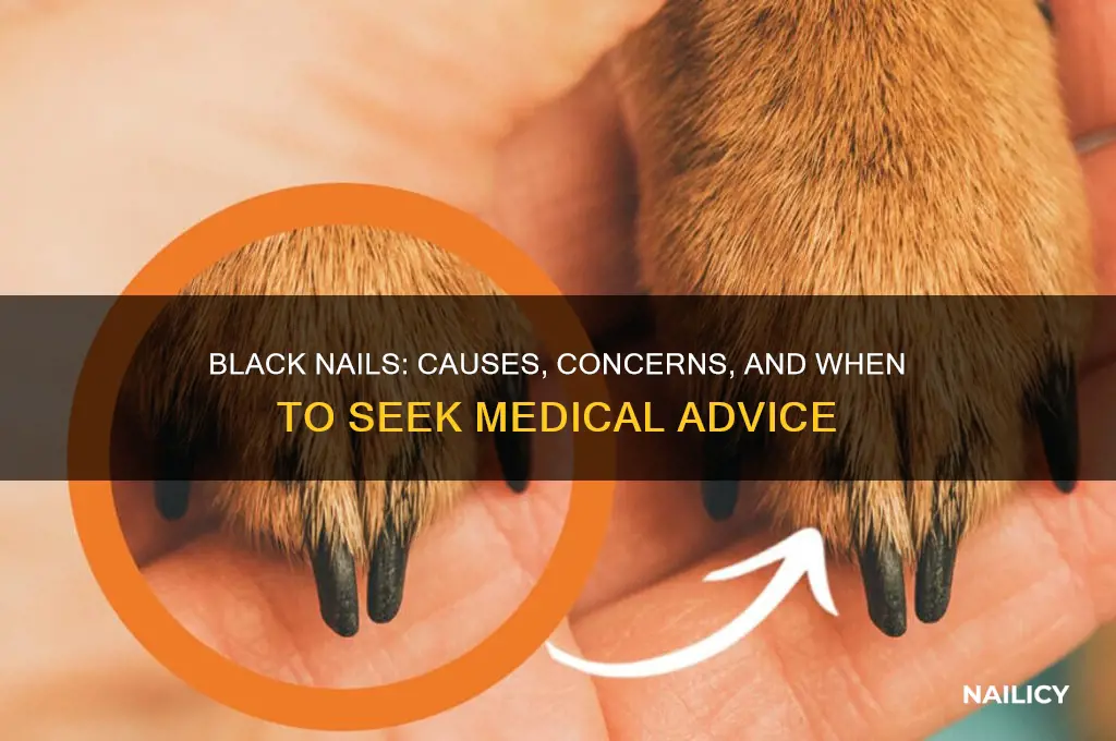 why are nails turning black