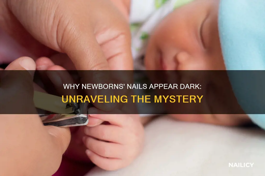 why are newborns nails dark