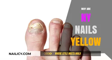 Why Are My Nails Yellow? Causes and Solutions Explained
