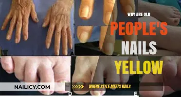 Why Do Elderly Nails Turn Yellow? Causes and Solutions Explained