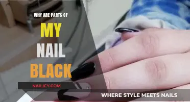 Black Spots on Nails: Causes, Concerns, and When to Seek Help