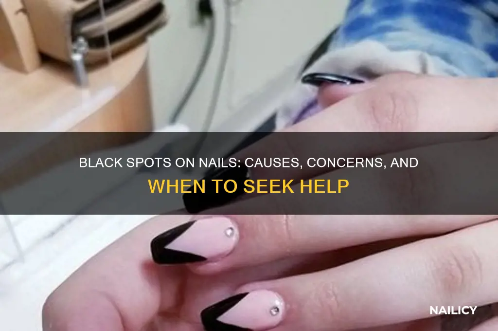 why are parts of my nail black