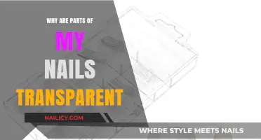 Transparent Nail Tips: Causes and What They Reveal About Your Health