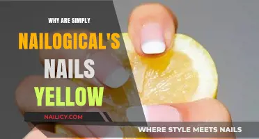 Why Simply Nailogical's Nails Are Yellow: Uncovering the Truth