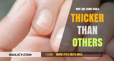 Understanding Nail Thickness: Factors Behind Varying Nail Strength and Growth