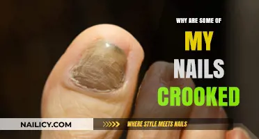 Crooked Nails Explained: Causes and Solutions for Uneven Nail Growth