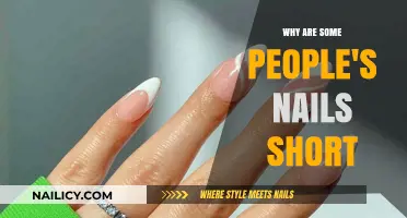 Why Some People Have Naturally Short Nails: Causes Explained