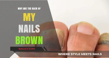 Why Are the Back of My Nails Brown? Causes and Solutions
