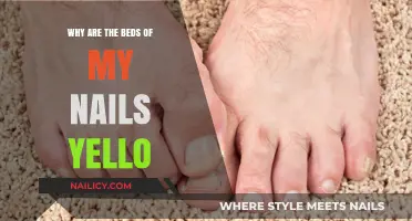 Yellow Nail Beds: Causes, Concerns, and Solutions Explained