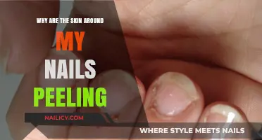 Peeling Skin Around Nails: Causes, Remedies, and Prevention Tips