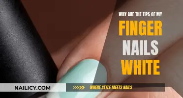 What Do White Fingernail Tips Indicate?