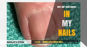 Ridges in Nails: Causes, Concerns, and When to Seek Help