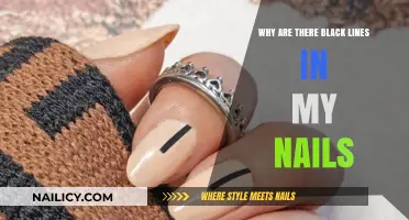 Black Lines on Nails: Causes, Concerns, and When to Seek Help