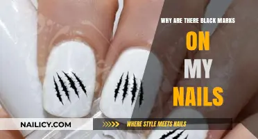 Black Marks on Nails: Causes, Concerns, and Solutions Explained