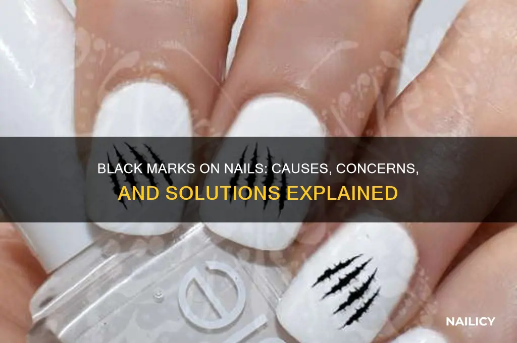 why are there black marks on my nails