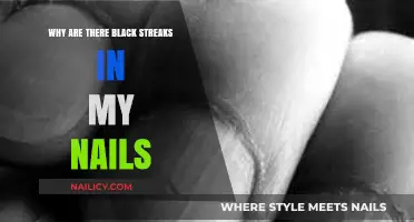Black Streaks on Nails: Causes, Concerns, and Solutions Explained
