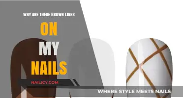 Brown Lines on Nails: Causes, Concerns, and Solutions Explained