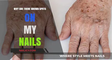 Brown Spots on Nails: Causes, Concerns, and Solutions Explained