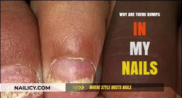 Bumpy Nails: Causes, Concerns, and When to Seek Help