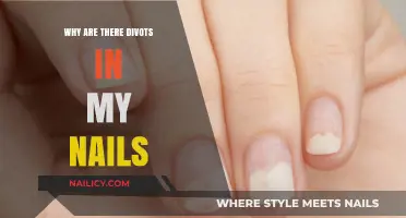 Why Do My Nails Have Divots? Causes and Solutions Explained