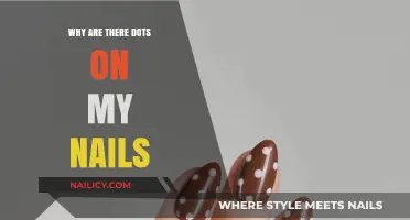 Understanding the Causes of Dots on Your Nails: A Comprehensive Guide