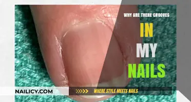 Why Do My Nails Have Grooves? Causes and Solutions Explained