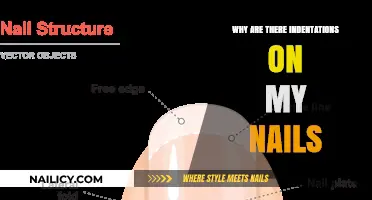 What Causes Nail Indentations? Understanding Vertical Ridges and Their Meaning