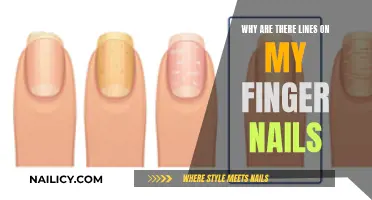 Unraveling the Mystery: Lines on Your Fingernails Explained