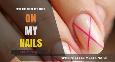 Red Lines on Nails: Causes, Concerns, and When to Seek Help