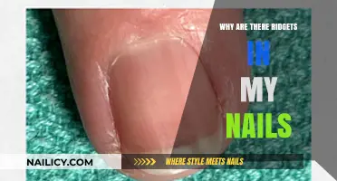 Understanding Nail Ridges: Causes, Concerns, and Care Tips Explained