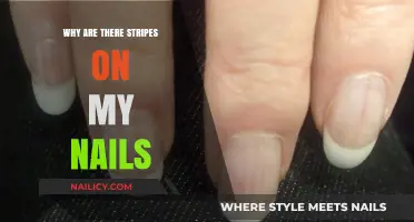 Understanding Nail Stripes: Causes, Concerns, and When to Seek Advice